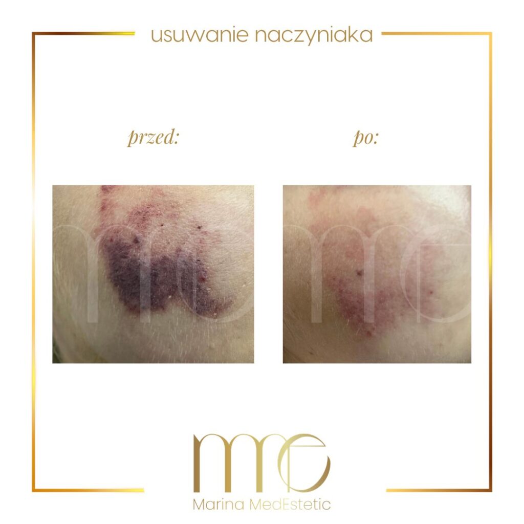 Marina MedEstetic|Metamorfozy