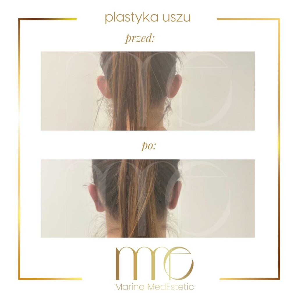 Marina MedEstetic|Metamorfozy