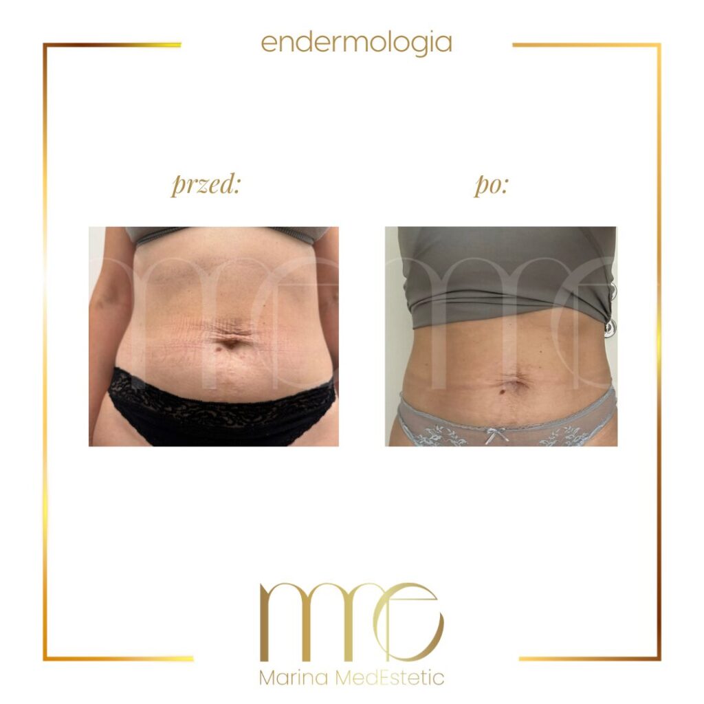 Marina MedEstetic|Metamorfozy