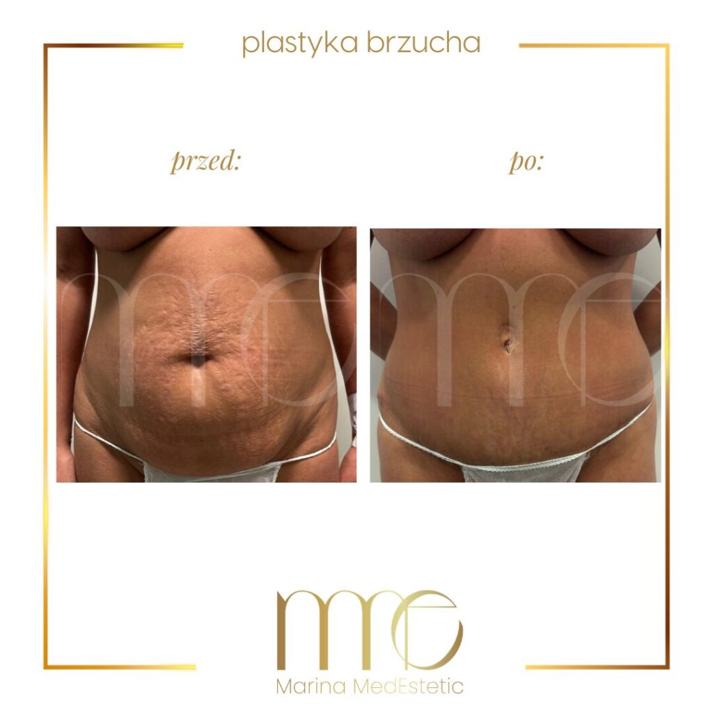 Marina MedEstetic|Metamorfozy