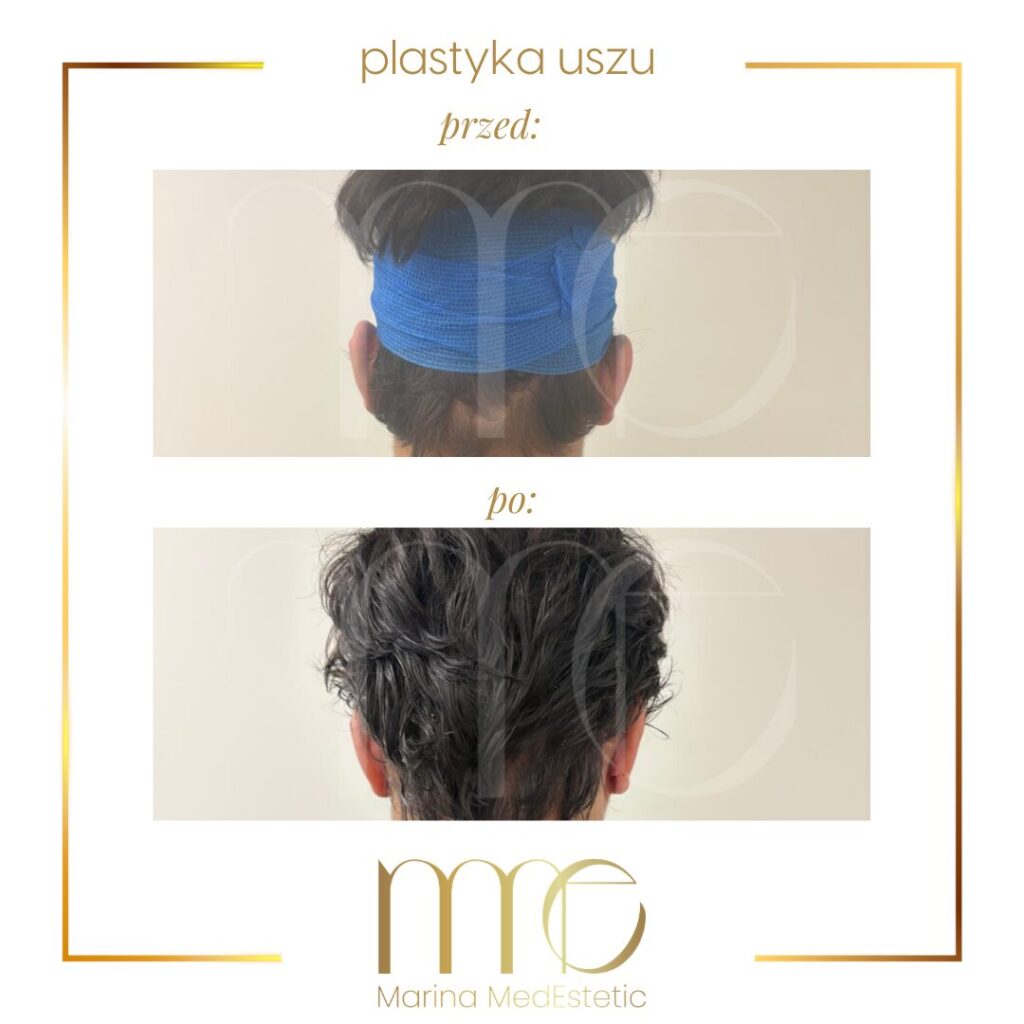 Marina MedEstetic|Metamorfozy