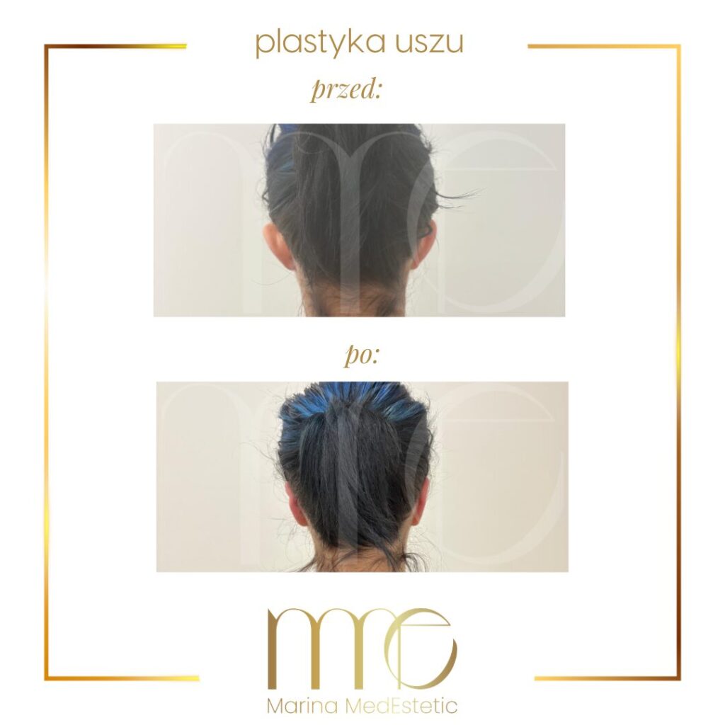 Marina MedEstetic|Metamorfozy