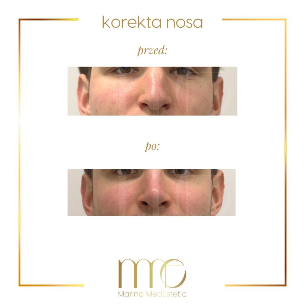 Marina MedEstetic|Metamorfozy
