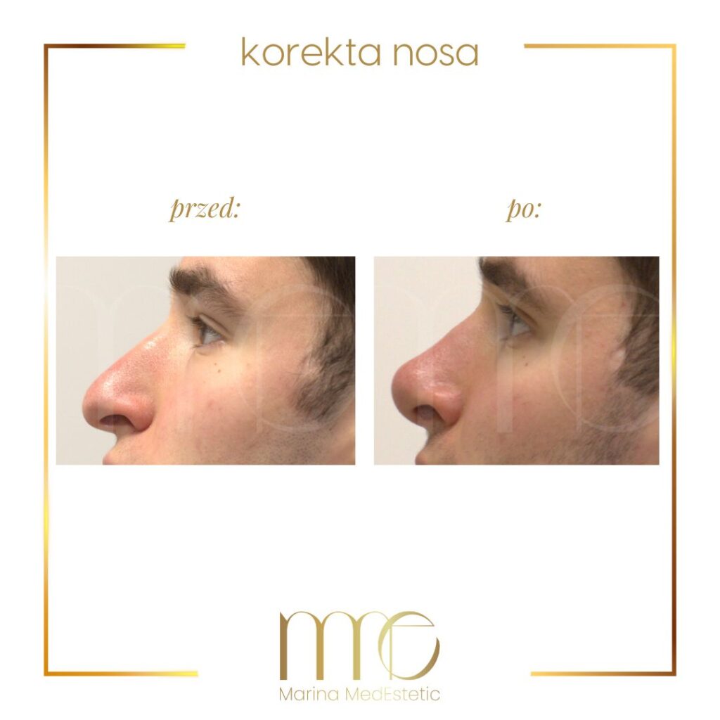 Marina MedEstetic|Metamorfozy
