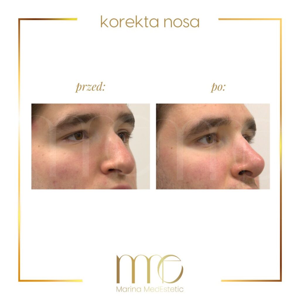 Marina MedEstetic|Metamorfozy