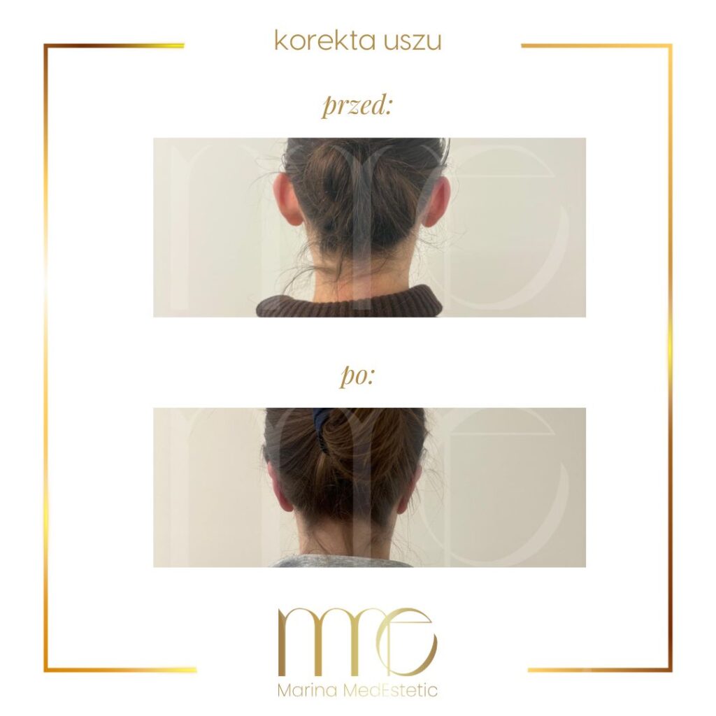 Marina MedEstetic|Metamorfozy