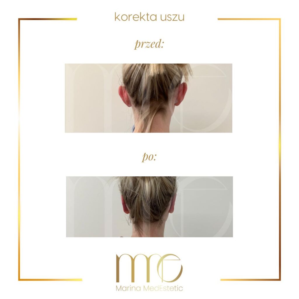 Marina MedEstetic|Metamorfozy
