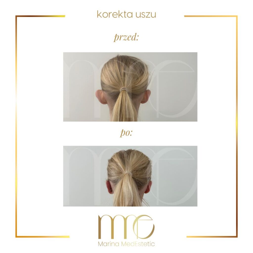 Marina MedEstetic|Metamorfozy