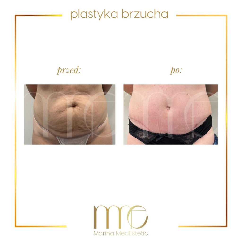 Marina MedEstetic|Metamorfozy