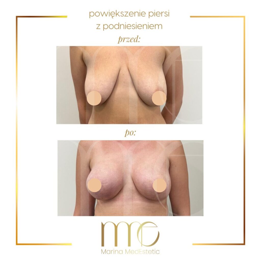Marina MedEstetic|Metamorfozy