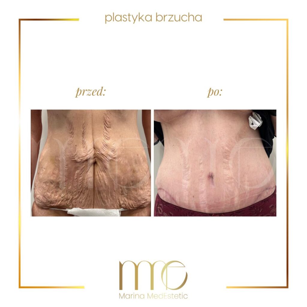 Marina MedEstetic|Metamorfozy