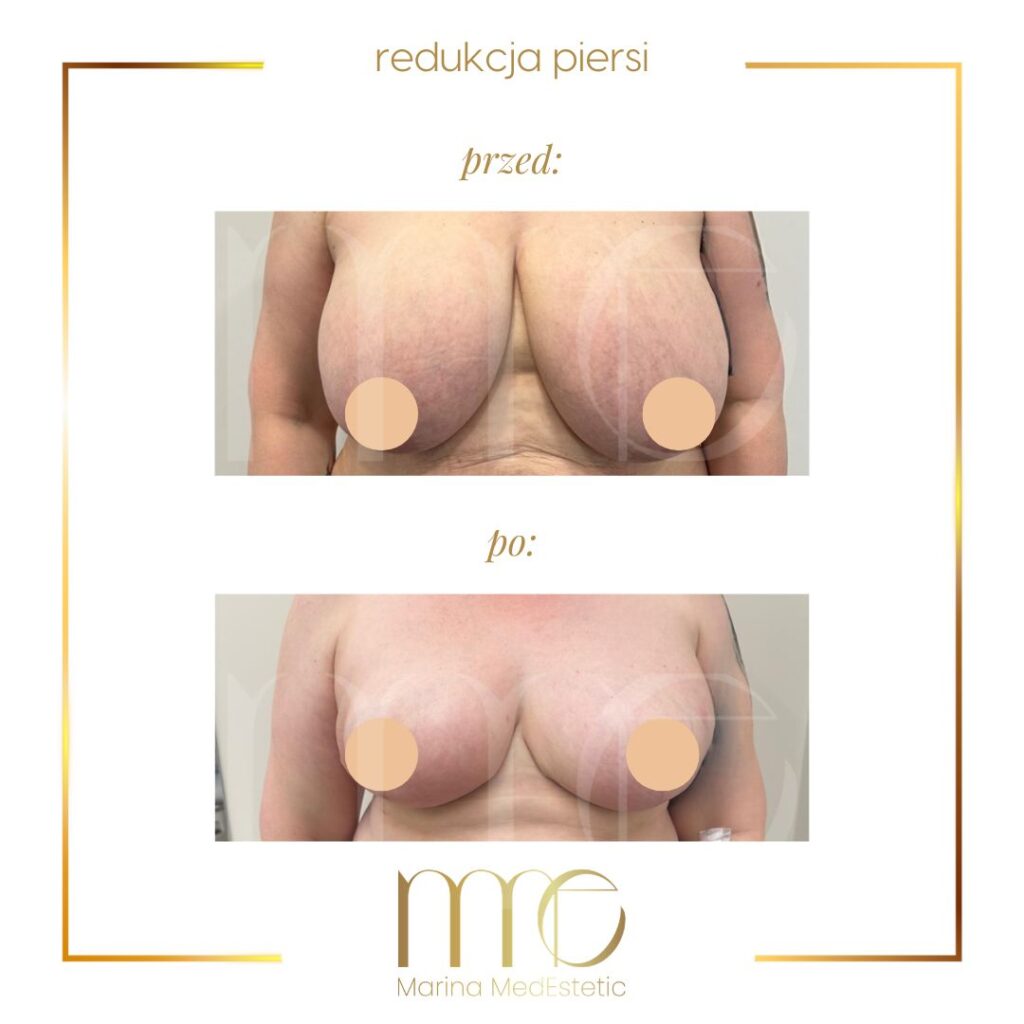 Marina MedEstetic|Metamorfozy