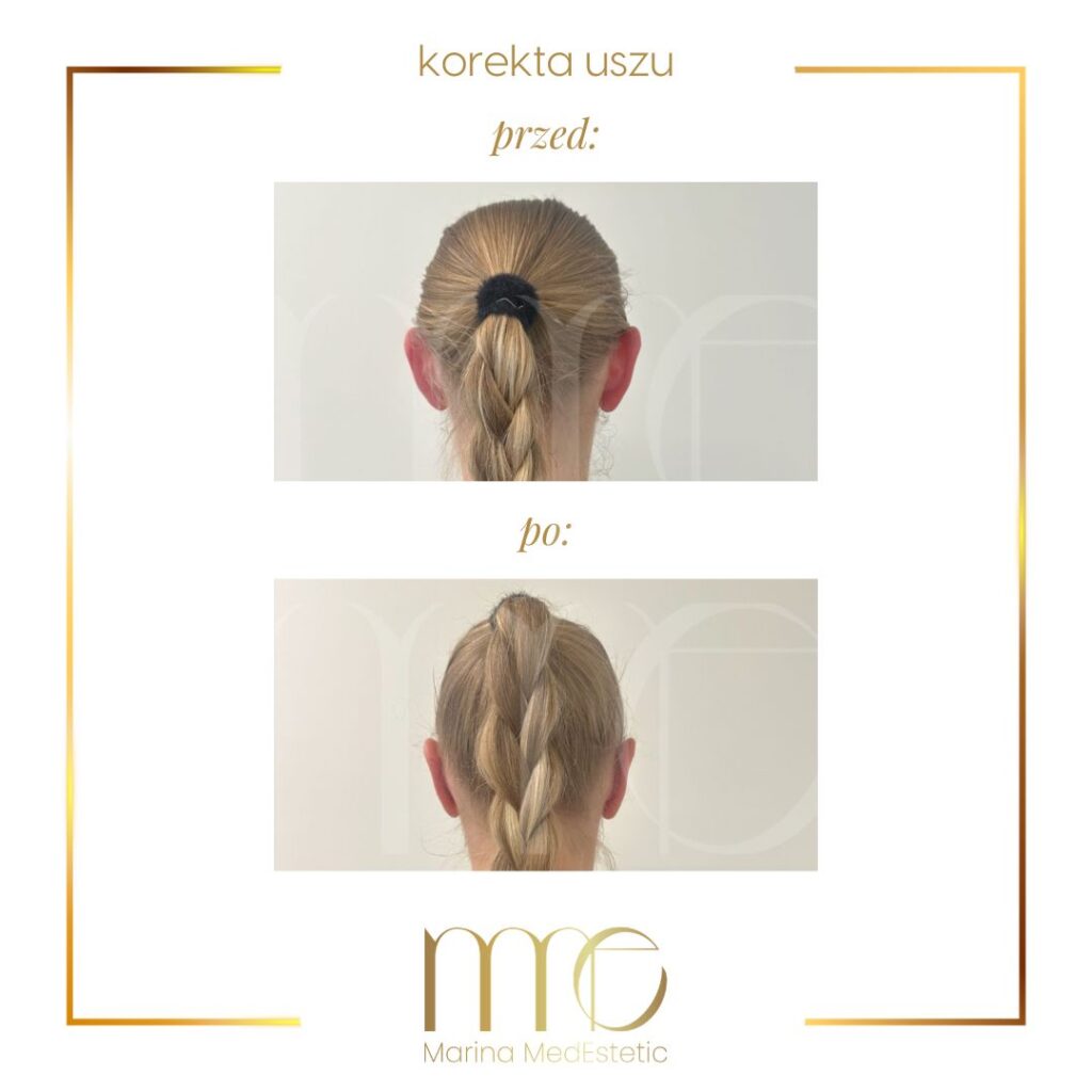 Marina MedEstetic|Metamorfozy